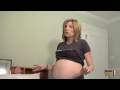 stretch mark treatment
