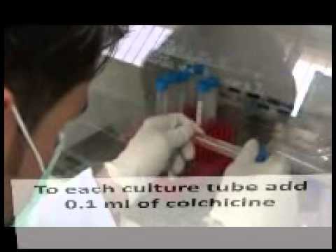 how to isolate lymphocytes from blood