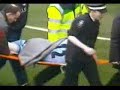 David Busst Horrific Injury