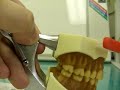 歯間ブラシの重要性