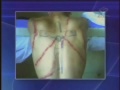 Policiais são os principais acusados de tortura no Brasil Policiais são os principais acusados de tortura no Brasil