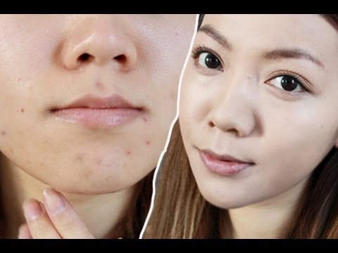 how to cover acne scars with bb cream