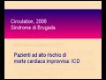 Sindrome di Brugada: complicanze del defibrillatore Sindrome di Brugada: complicanze del defibrillatore