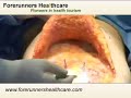 Combine your Cosmetic Surgery in India with attractive Holiday Packages