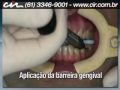 Clareamento dental em brasilia