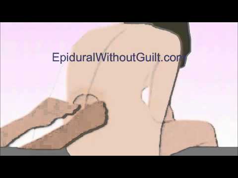 how to relieve epidural pain
