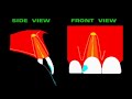 dental