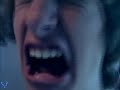 Thumbnail #2