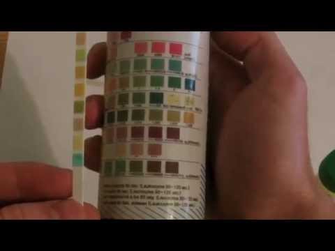 how to obtain urinalysis