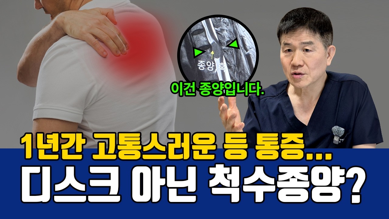 목디스크인 줄 알았는데 척수종양? | 신경 손상 최소화하는 척수종양 수술법