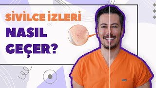 Sivilce İzleri Nasıl Geçer? Akne İzleri Tedavi