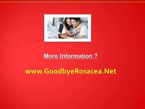 how to cure rosacea redness