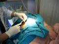Plastic surgical operation Bangkok Hospital Samui Thailand