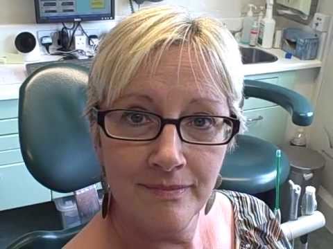 how to whiten capped teeth