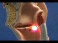 Bronchial Tree Model - Larynx - Sagittal View