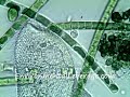 Paramecium 1000x