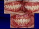 orthodontist6 orthodontist6