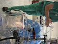Priming the V-Bag