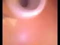 Thumbnail #3