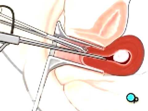vagina
