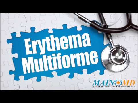 how to relieve erythema multiforme