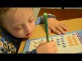 Down syndrome:&nbsp;Down Syndrome doing maths