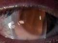 voyeur