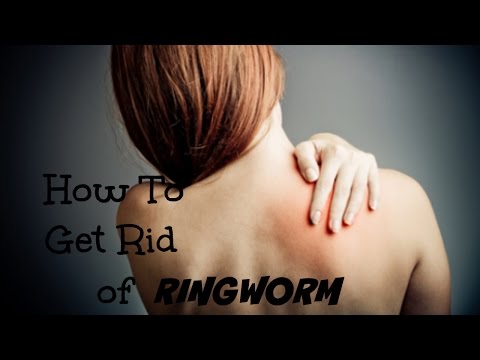 how to eliminate ringworm