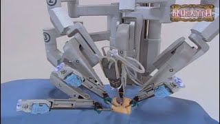 第31回手術支援ロボット