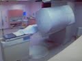 Prostate Cancer External RadiotherapyTreatment - Part 2 Prostate Cancer External RadiotherapyTreatment - Part 2
