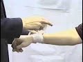 Reverse Spiral Bandage Reverse Spiral Bandage
