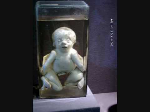 0 Kunstkamera, el Museo de los Horrores