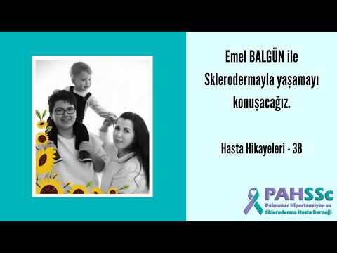 Hasta Hikayeleri - Emel BALGÜN ile Sklerodermayla Yaşamak - 38 - 2021.05.11