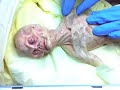 Alien Autopsy