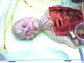 Alien Autopsy Alien Autopsy