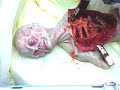 Alien Autopsy