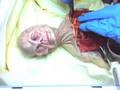 Alien Autopsy