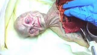 Alien Autopsy ผ่าศพเอเลี่ยน