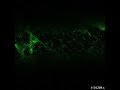 Green Fluorescent Protein in the endoplasmic reticulum