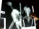 Injured Peregine X-Ray Explanation