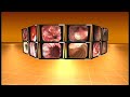 Gastrointestinal Endoscopy
