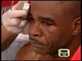Roy Jones Jr. Worst fight Ever