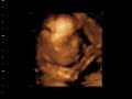 Maddox