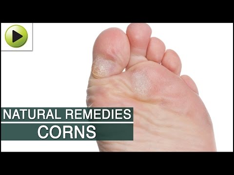 how to dissolve bunions naturally