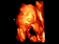 Hugo, meu filho ainda no �tero da mam�e. Lindo n�o?!