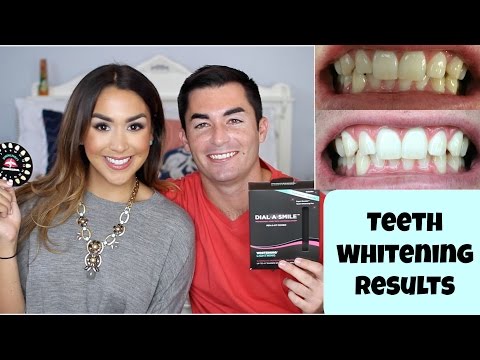 how to whiten gaps between teeth