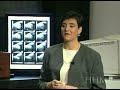 Echocardiogram
