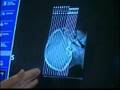 CT Scan