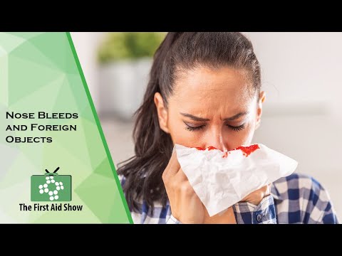 how to pinch a nose bleed