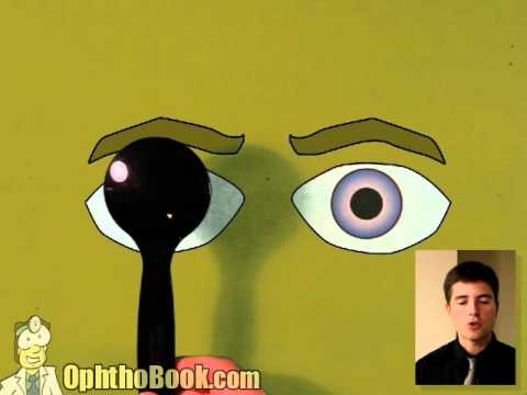 how to perform ocular motility test
